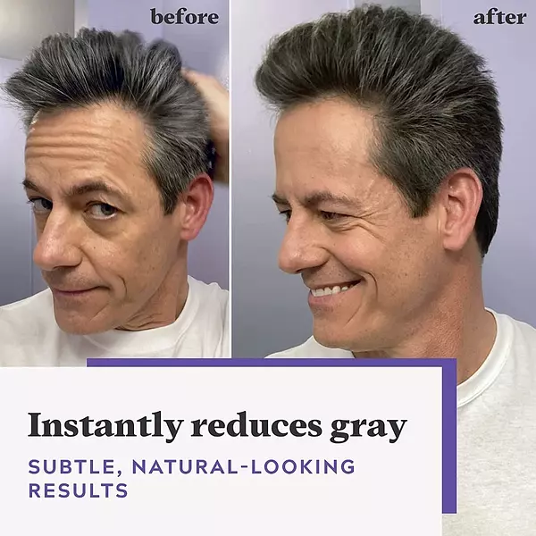 Salud y Equipamiento Médico - Tinte De Cabello Marrón Oscuro 4