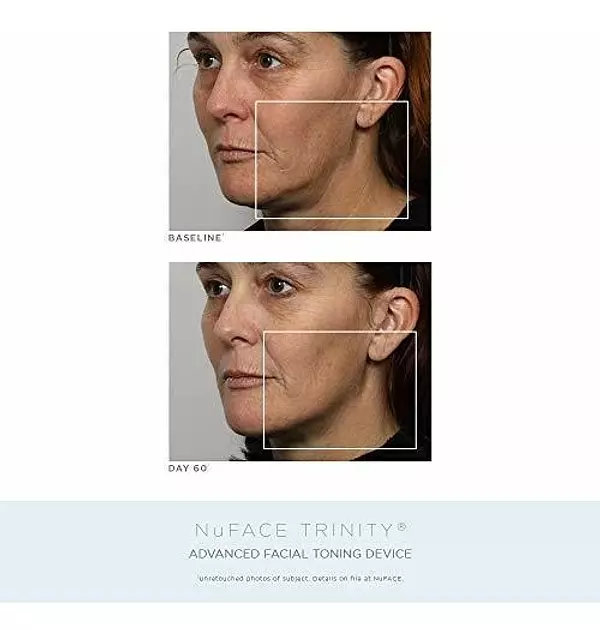 Salud y Equipamiento Médico - Kit Completo De Tonificacion Facial De Aniversario Nuface | 2