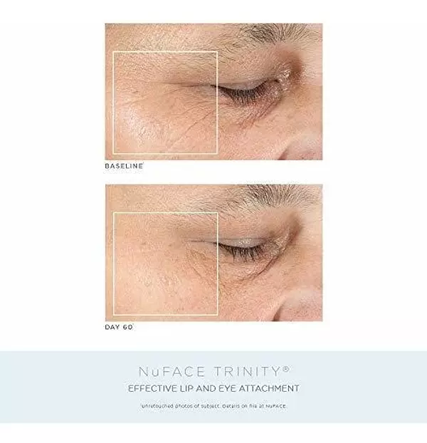 Salud y Equipamiento Médico - Kit Completo De Tonificacion Facial De Aniversario Nuface | 3