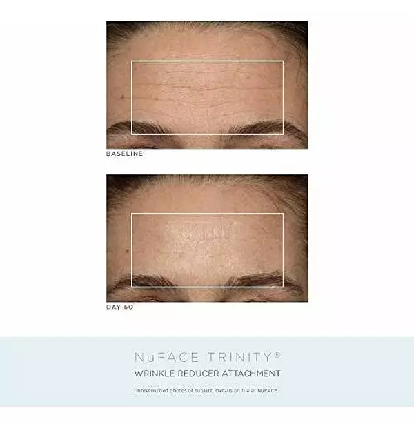 Salud y Equipamiento Médico - Kit Completo De Tonificacion Facial De Aniversario Nuface | 4