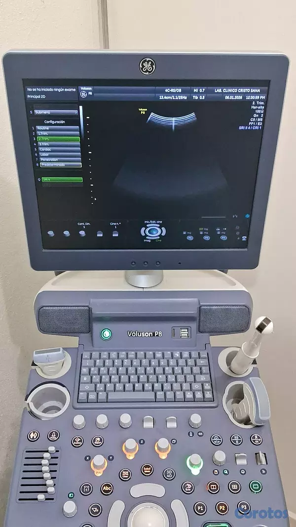 equipos profesionales - 🔬 Se vende Sonógrafo / Ultrasonido 12