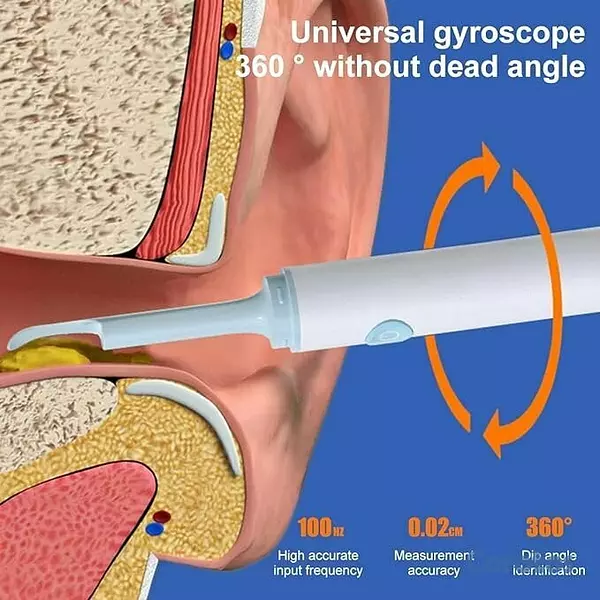 Salud y Equipamiento Médico - CAMARA ENDOSCOPICA PARA OIDO BISUTIME BS-10  4