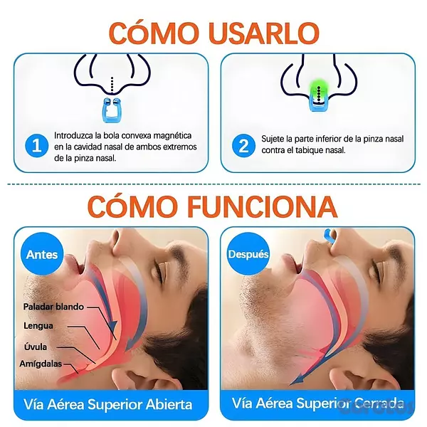 Salud y Equipamiento Médico - 😴 Clip Nasal Antironquidos – Ayuda para no Roncar  7